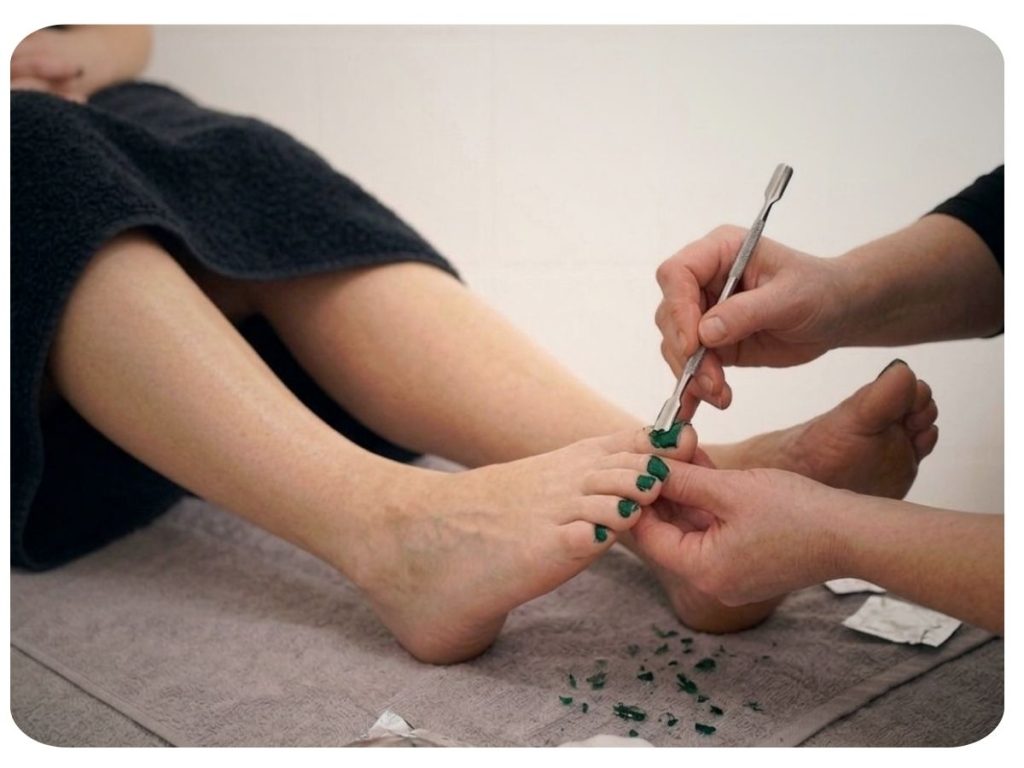 gellak-teennagels-verwijderen-zoetermeer-pijnacker-centre-du-lac